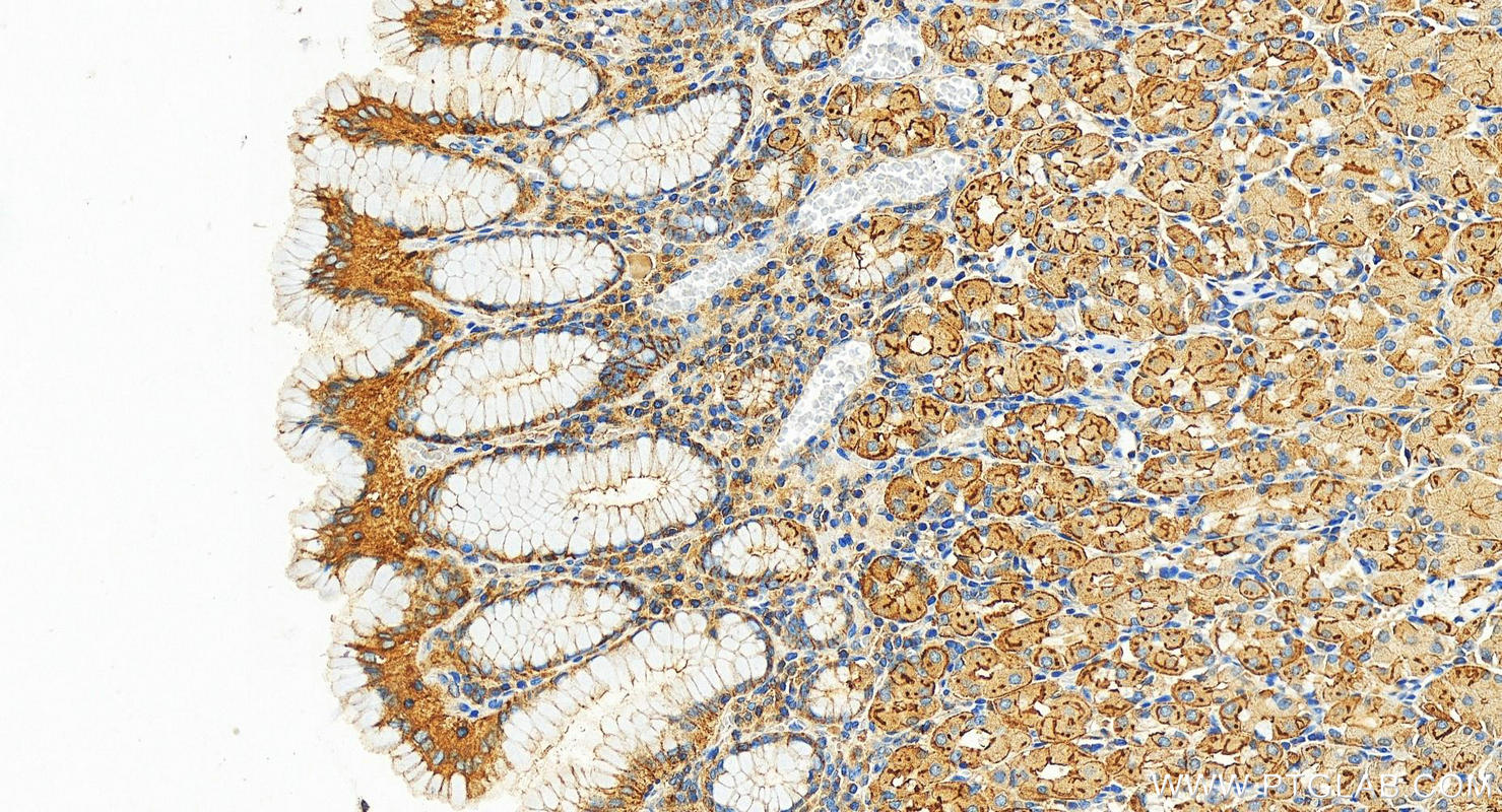 IHC staining of human stomach using 11227-1-AP