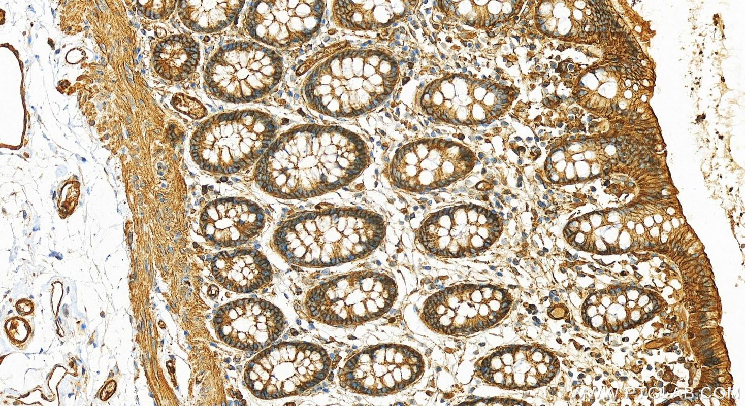 IHC staining of human colon using 11313-2-AP