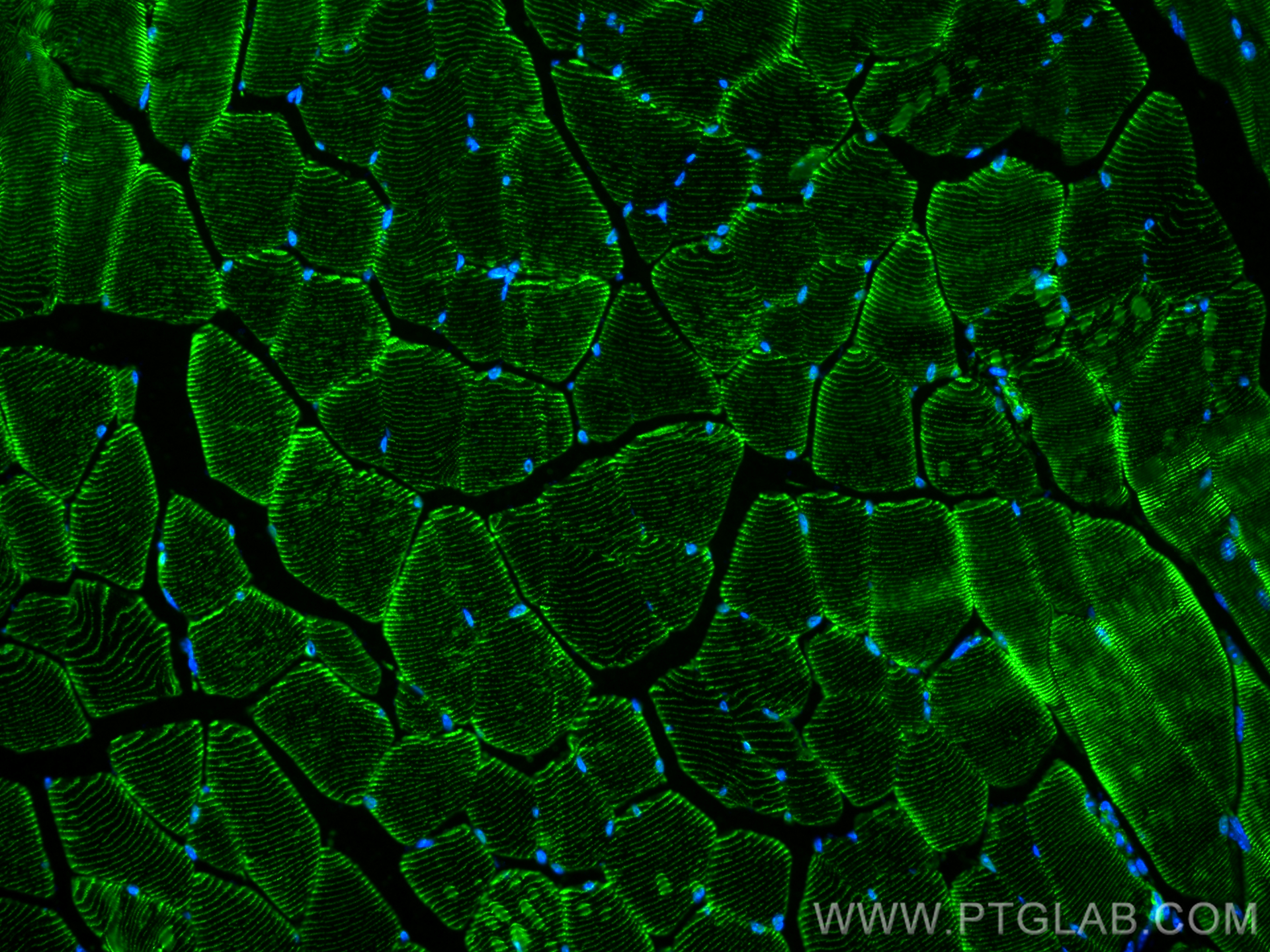 IF Staining of mouse skeletal muscle using 11313-2-AP