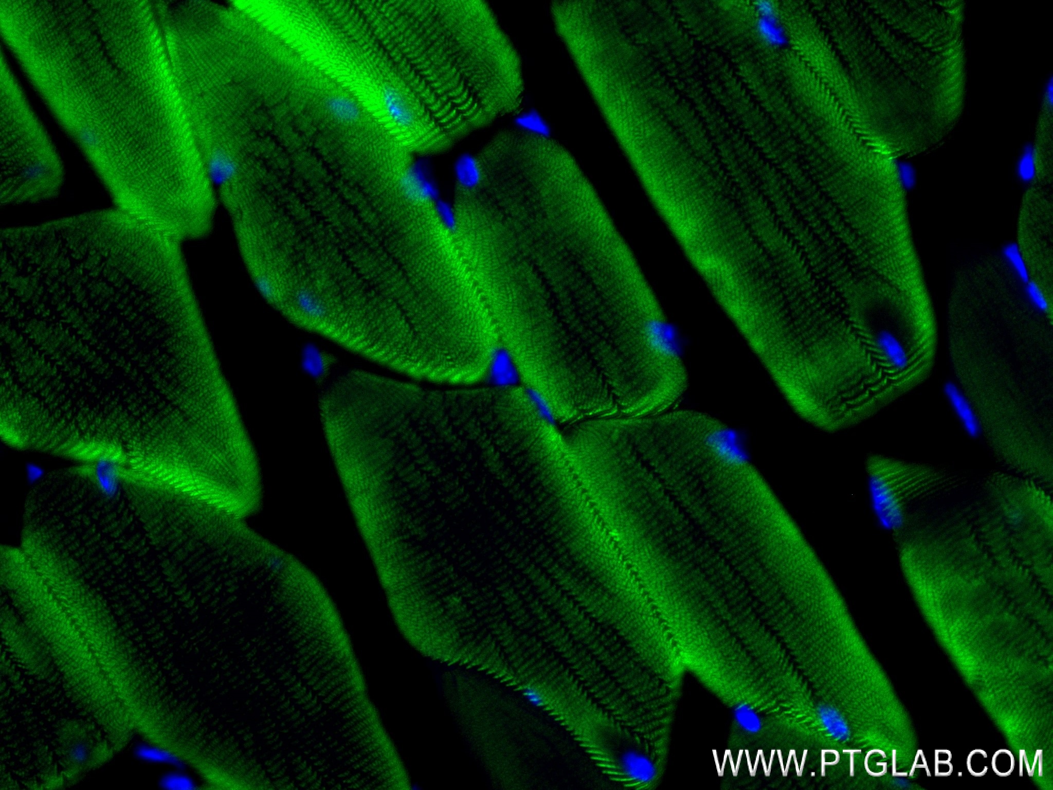 IF Staining of mouse skeletal muscle using 84356-1-RR (same clone as 84356-1-PBS)