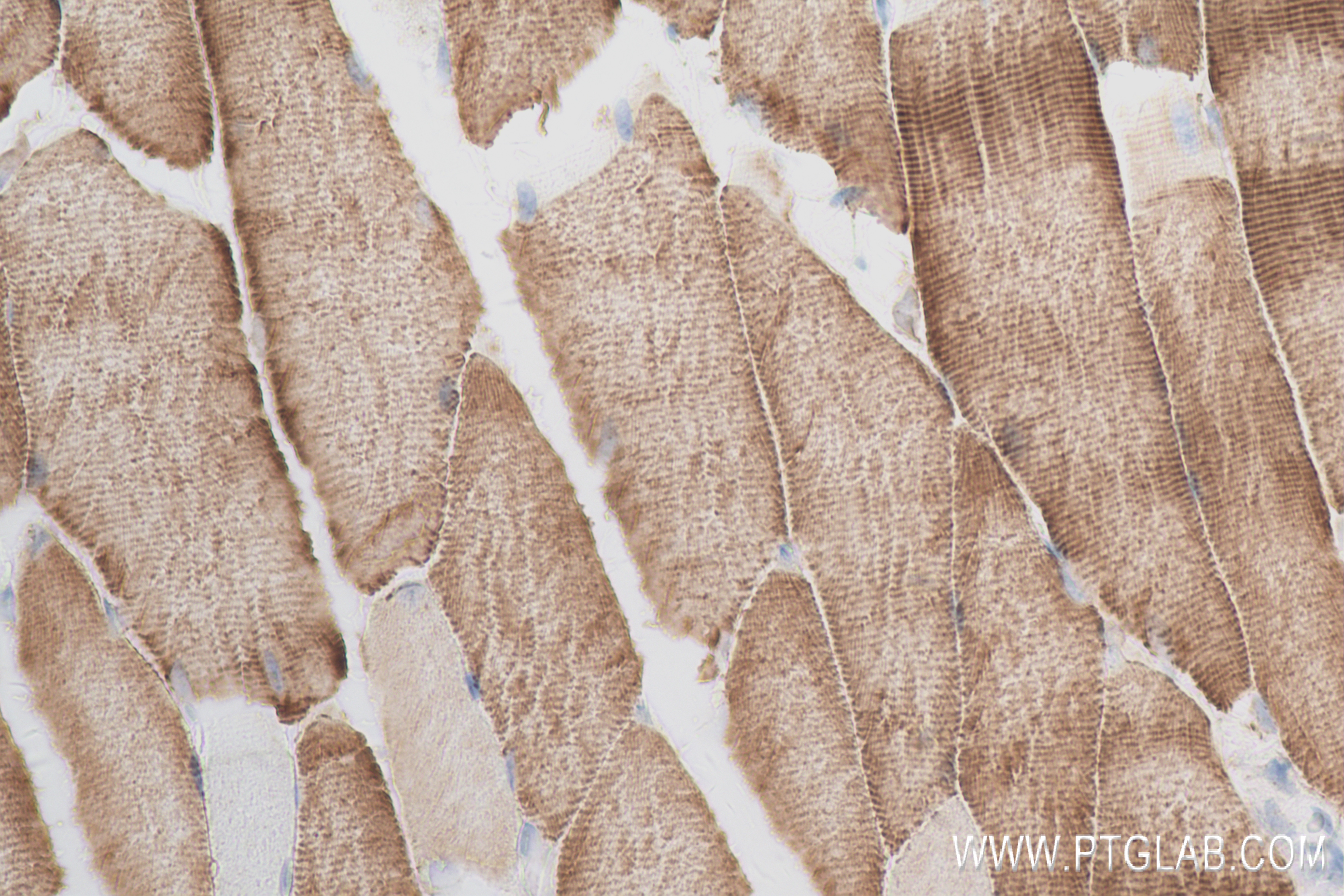 IHC staining of mouse skeletal muscle using 84356-1-RR (same clone as 84356-1-PBS)