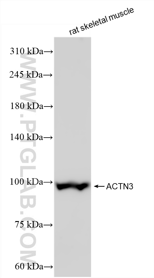 WB analysis of rat skeletal muscle using 84356-1-RR (same clone as 84356-1-PBS)