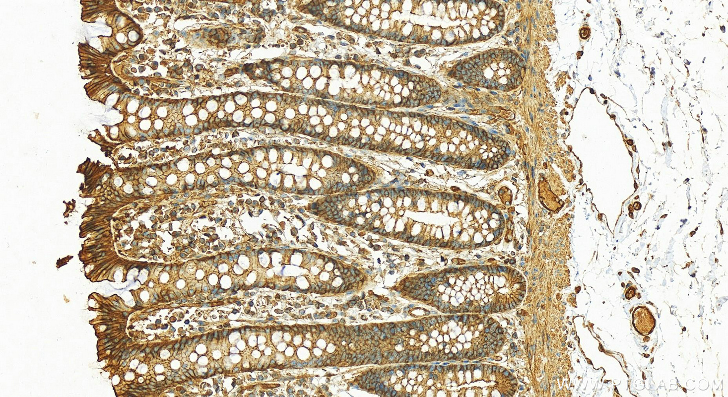 IHC staining of human colon using 19096-1-AP