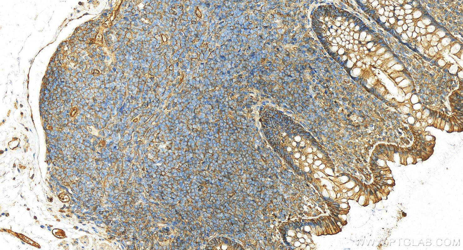 IHC staining of human normal colon using 19096-1-AP