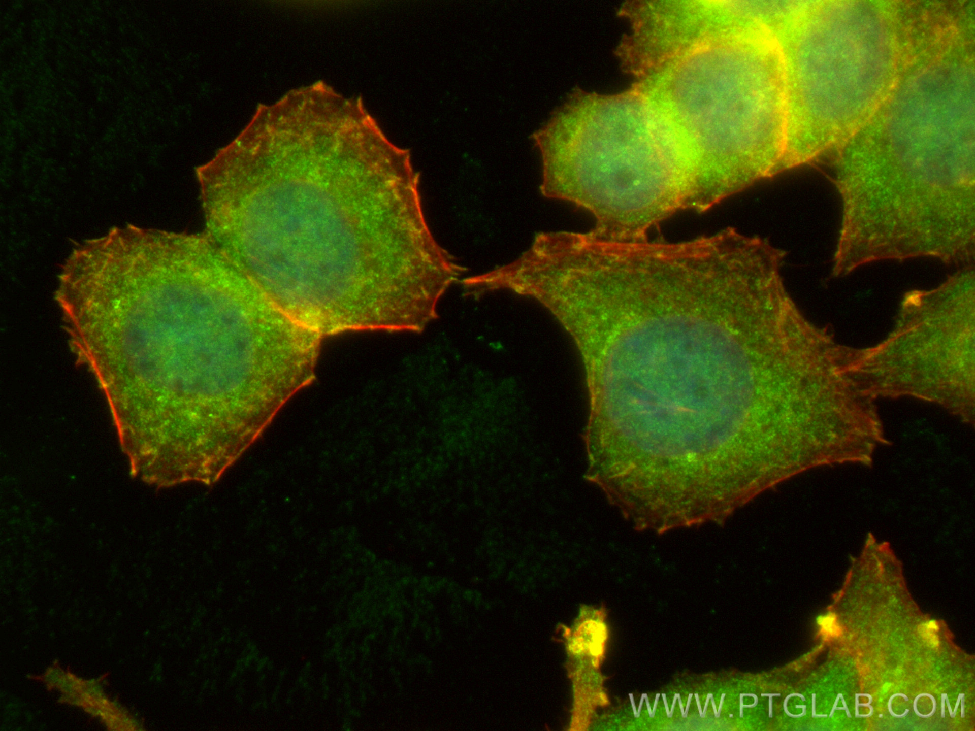 IF Staining of MCF-7 using 19096-1-AP