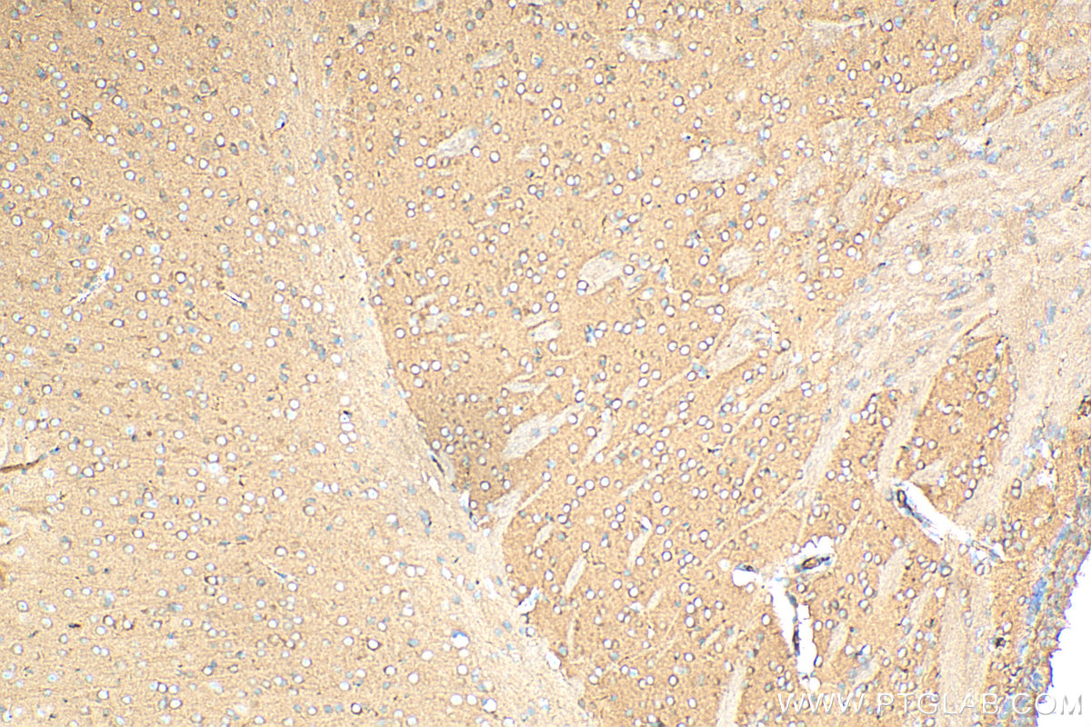 IHC staining of mouse brain using 68037-1-Ig