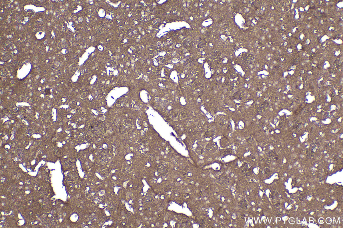 IHC staining of mouse brain using 83026-6-RR