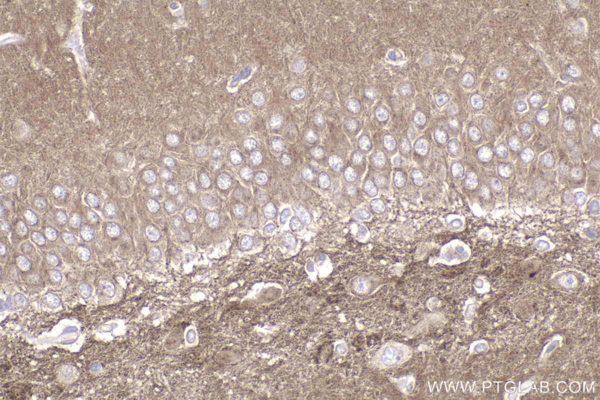 IHC staining of rat brain using 83026-6-RR