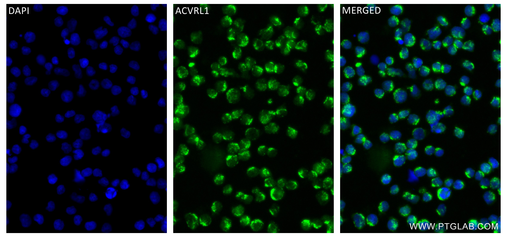 IF Staining of Jurkat using 84421-1-RR