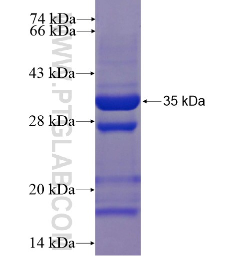 ACYP2 fusion protein Ag2948 SDS-PAGE