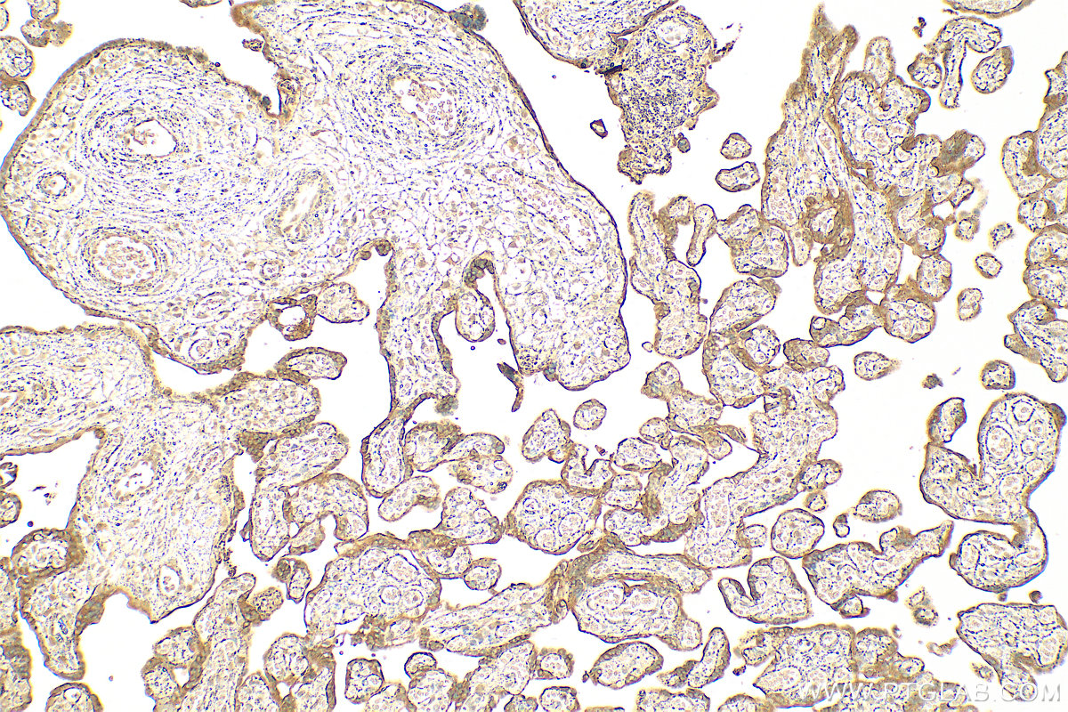 IHC staining of human placenta using 14139-1-AP