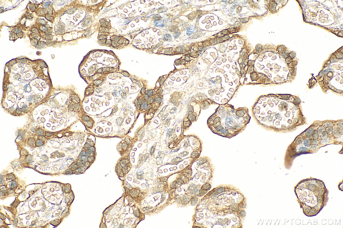 IHC staining of human placenta using 14139-1-AP