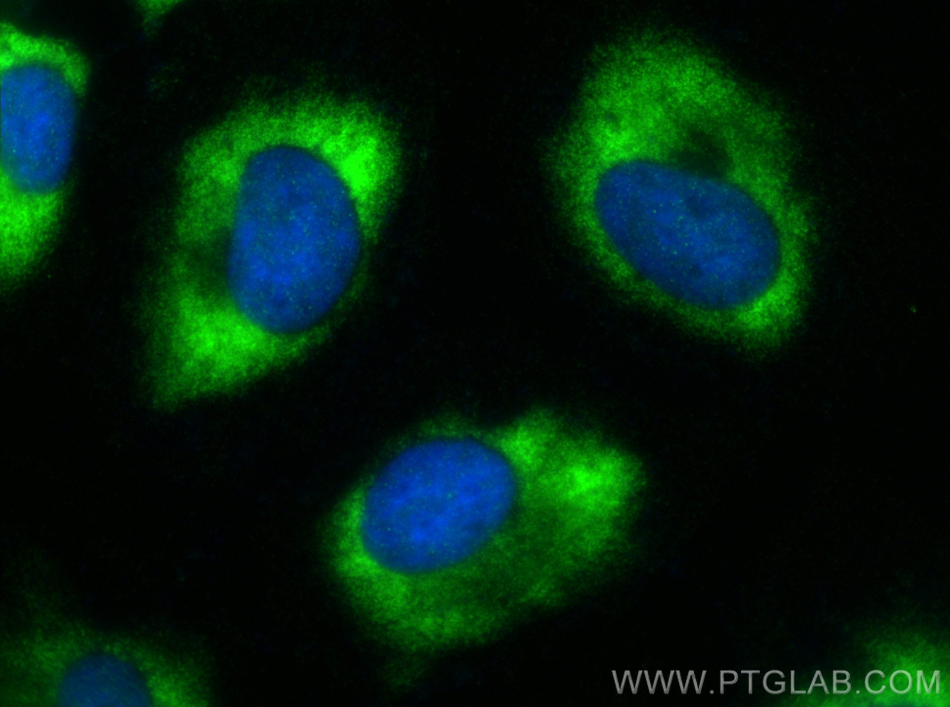 IF Staining of HeLa using 22147-1-AP (same clone as 22147-1-PBS)