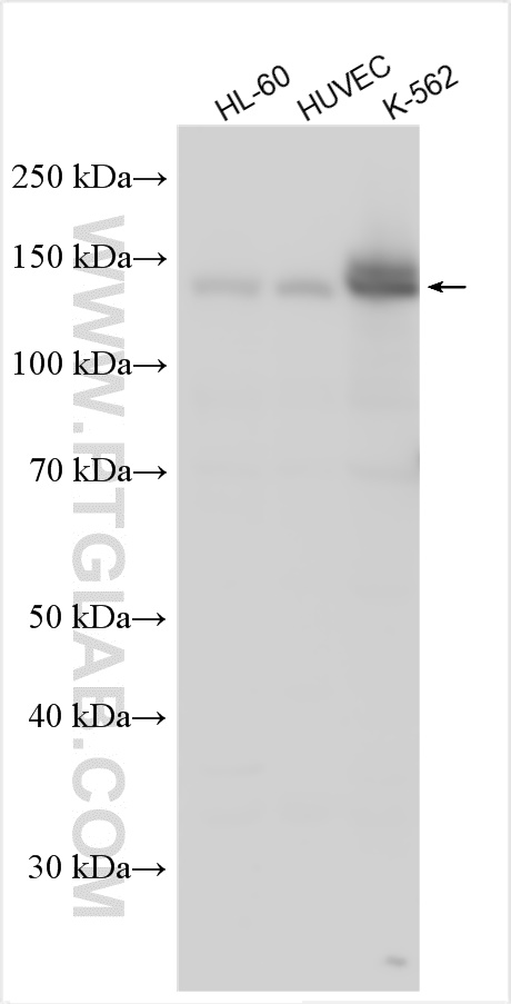 WB analysis using 31075-1-AP