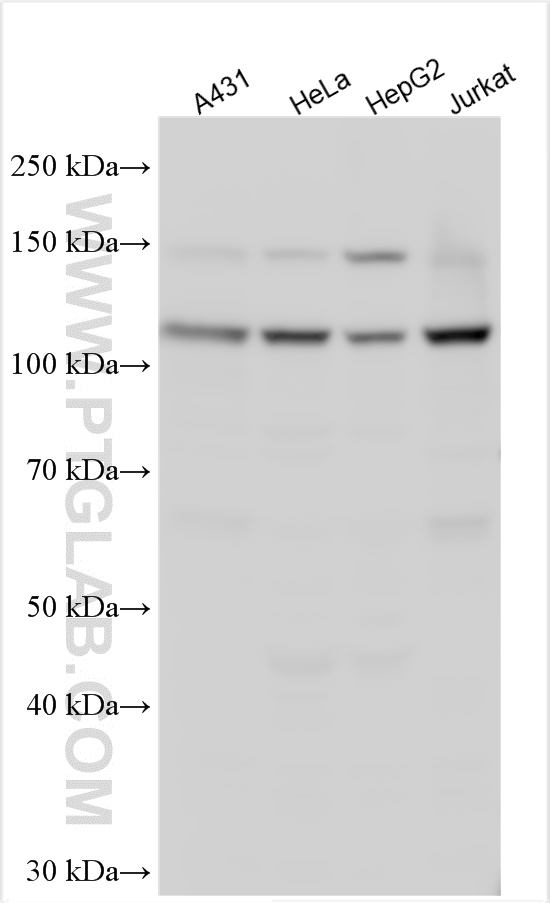 WB analysis using 14330-1-AP