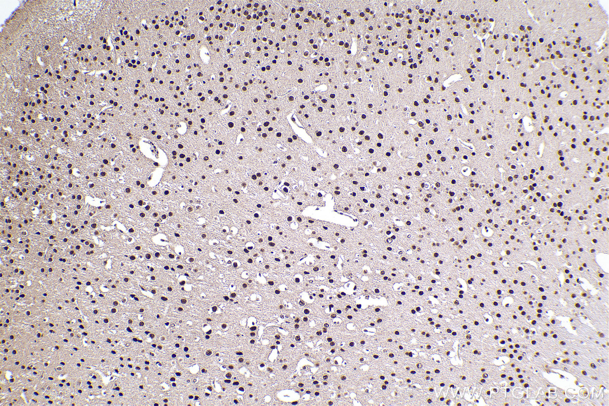 IHC staining of mouse brain using 22248-1-AP