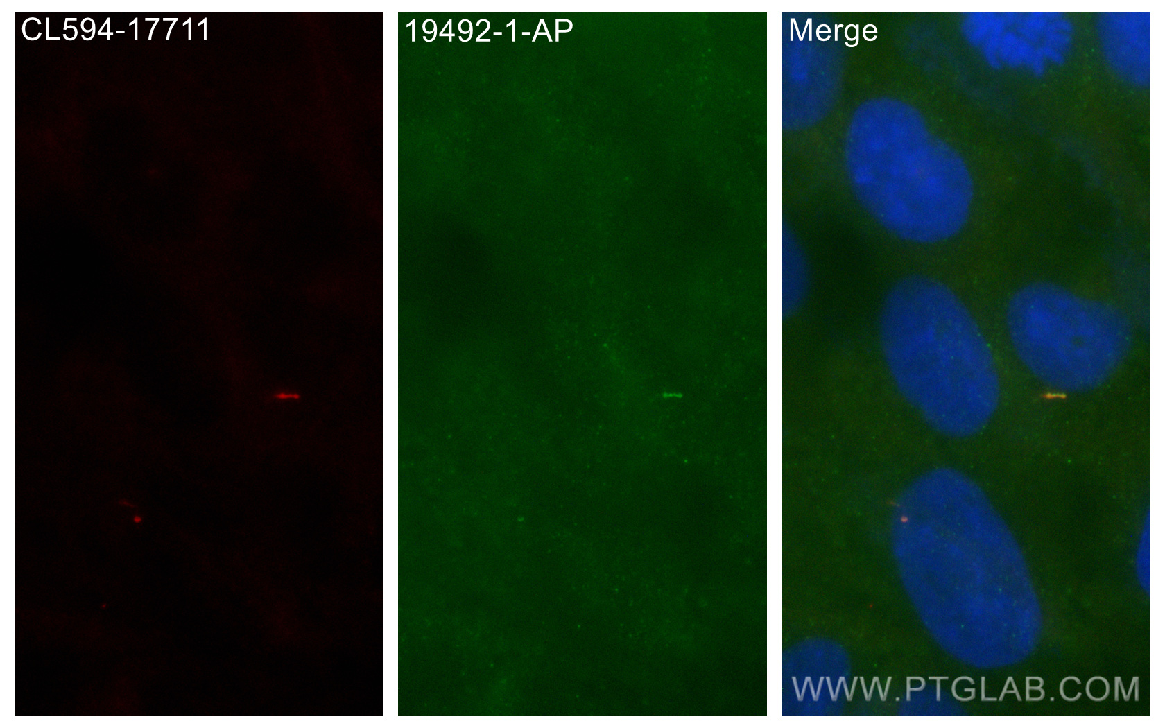 IF Staining of hTERT-RPE1 using 19492-1-AP