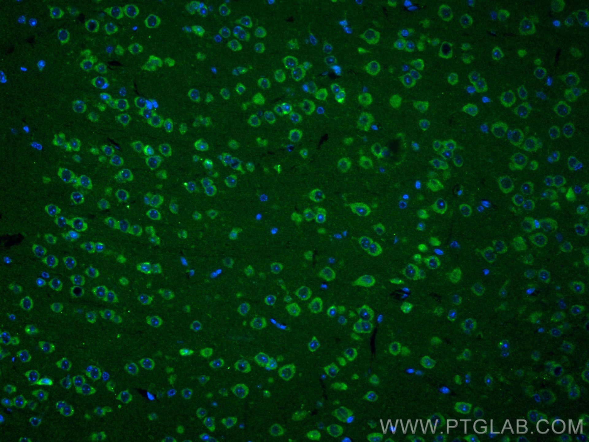 IF Staining of mouse brain using 30153-1-AP