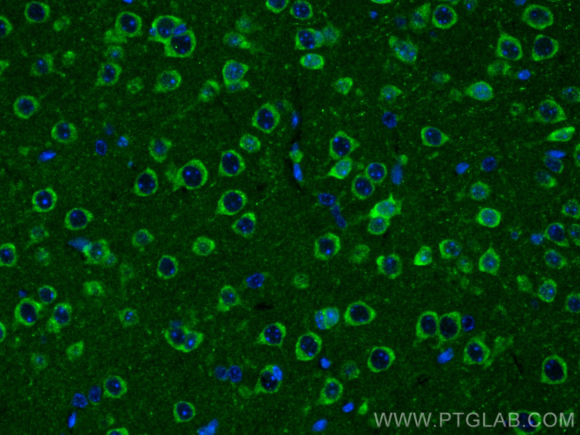 IF Staining of mouse brain using 30153-1-AP