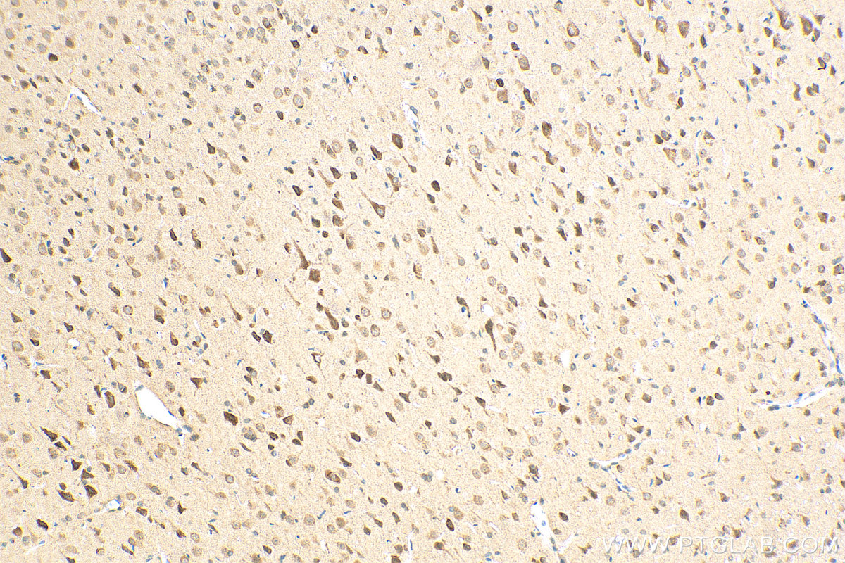 IHC staining of rat brain using 30153-1-AP