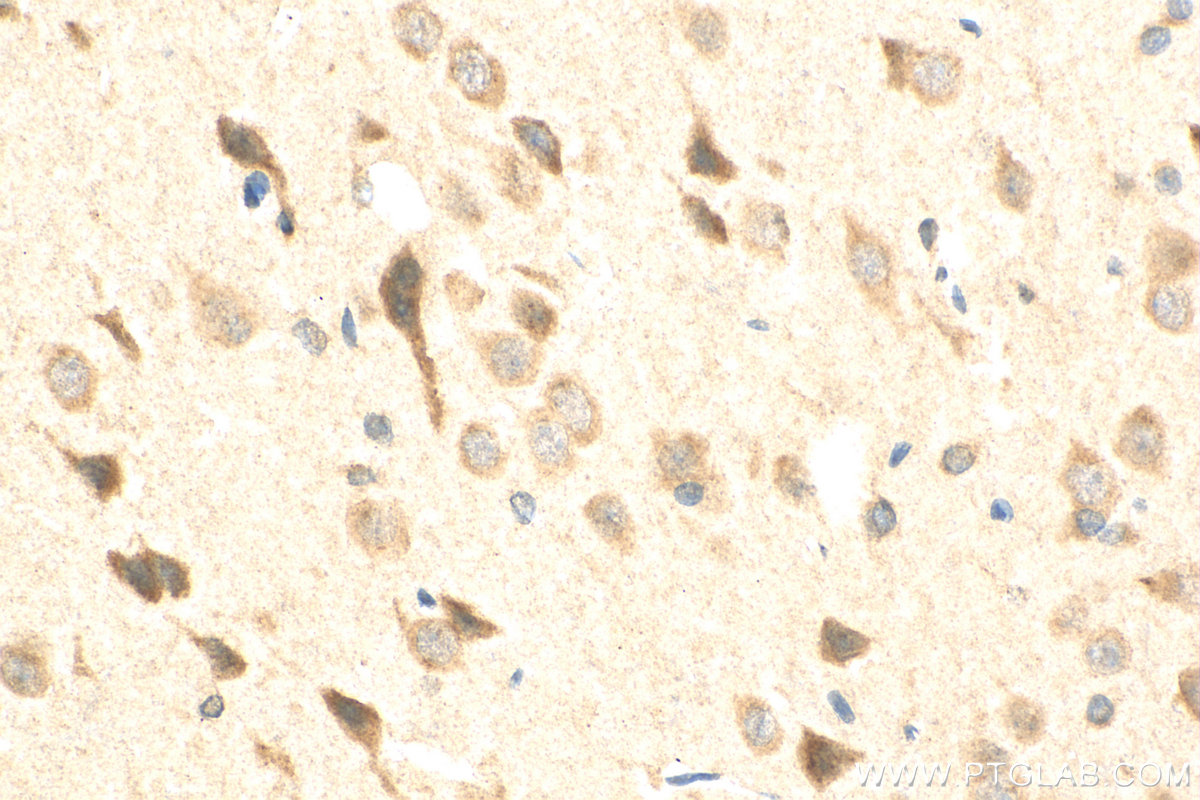 IHC staining of rat brain using 30153-1-AP