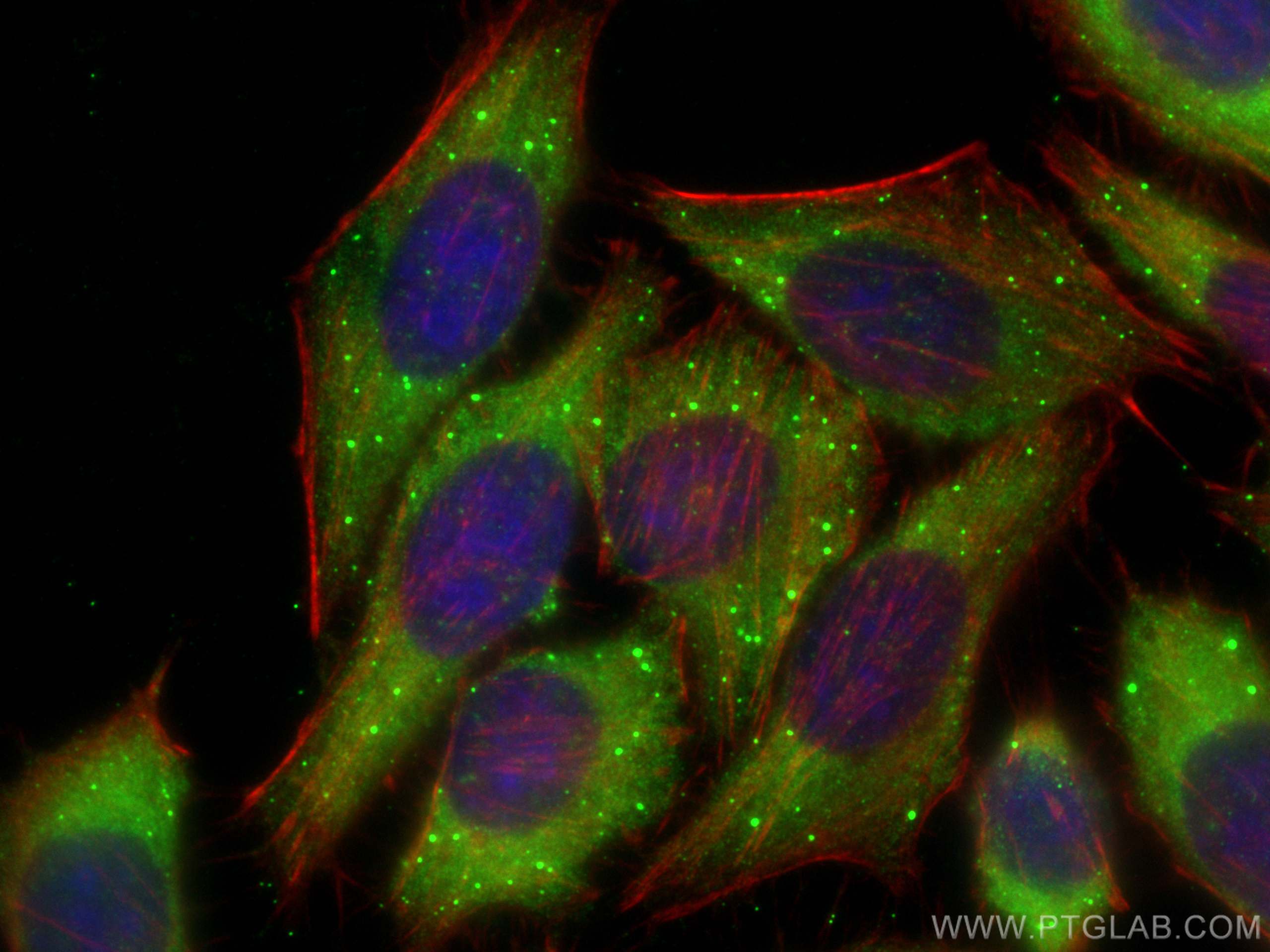 IF Staining of HepG2 using 18897-1-AP