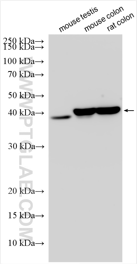 WB analysis using 30621-1-AP