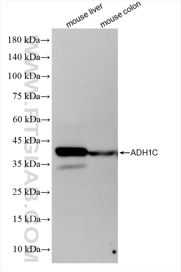 ADH1C