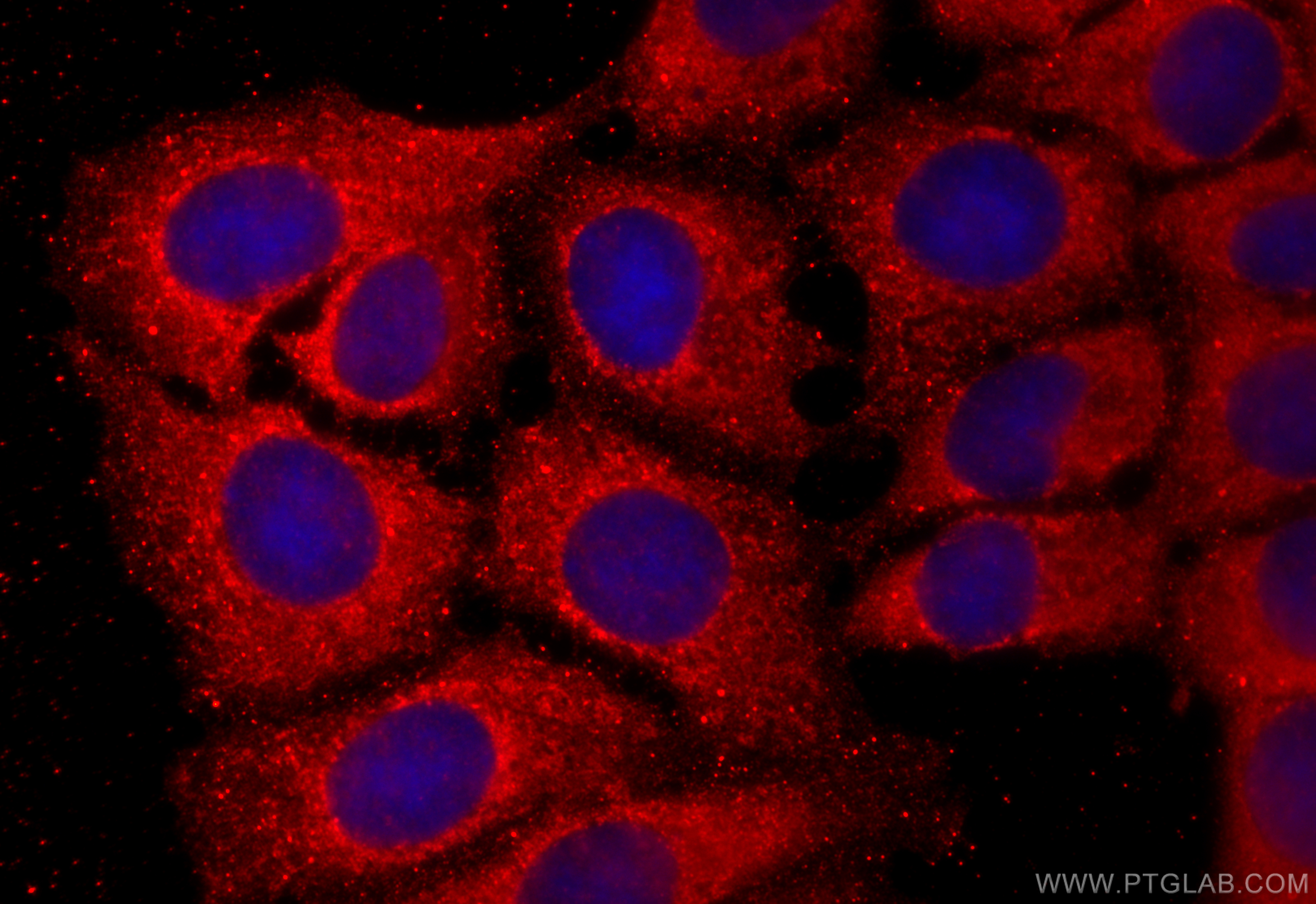 IF Staining of MCF-7 using 13288-2-AP