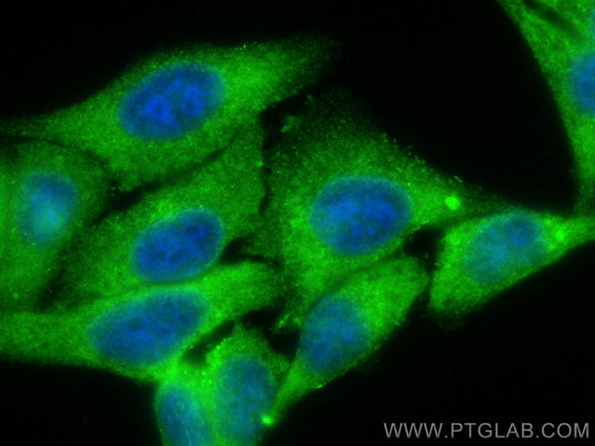 IF Staining of HepG2 using 23425-1-AP