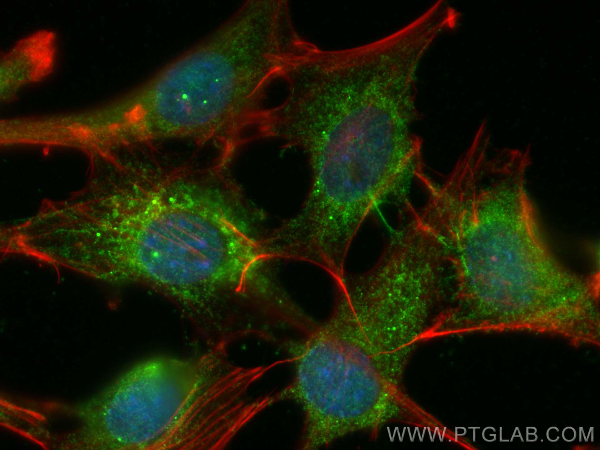 IF Staining of 3T3-L1 using 21613-1-AP