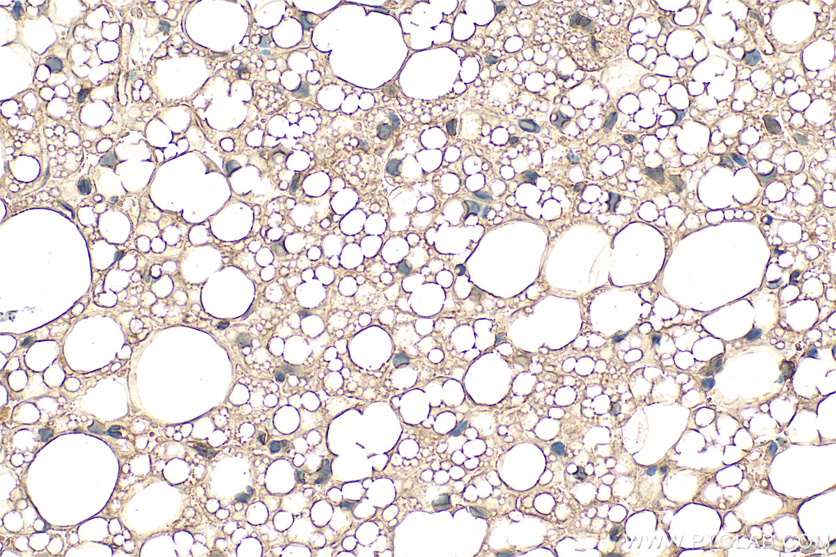 IHC staining of rat brown adipose using 66239-1-Ig