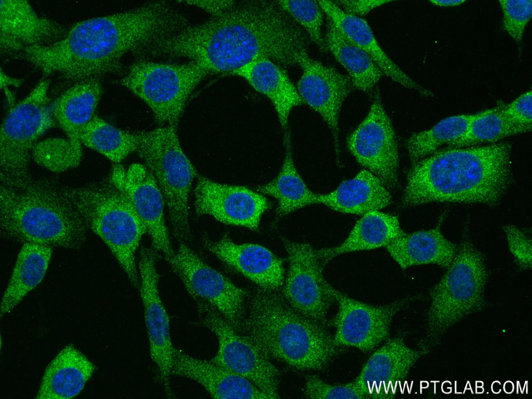 IF Staining of 3T3-L1 using 83961-3-RR (same clone as 83961-3-PBS)