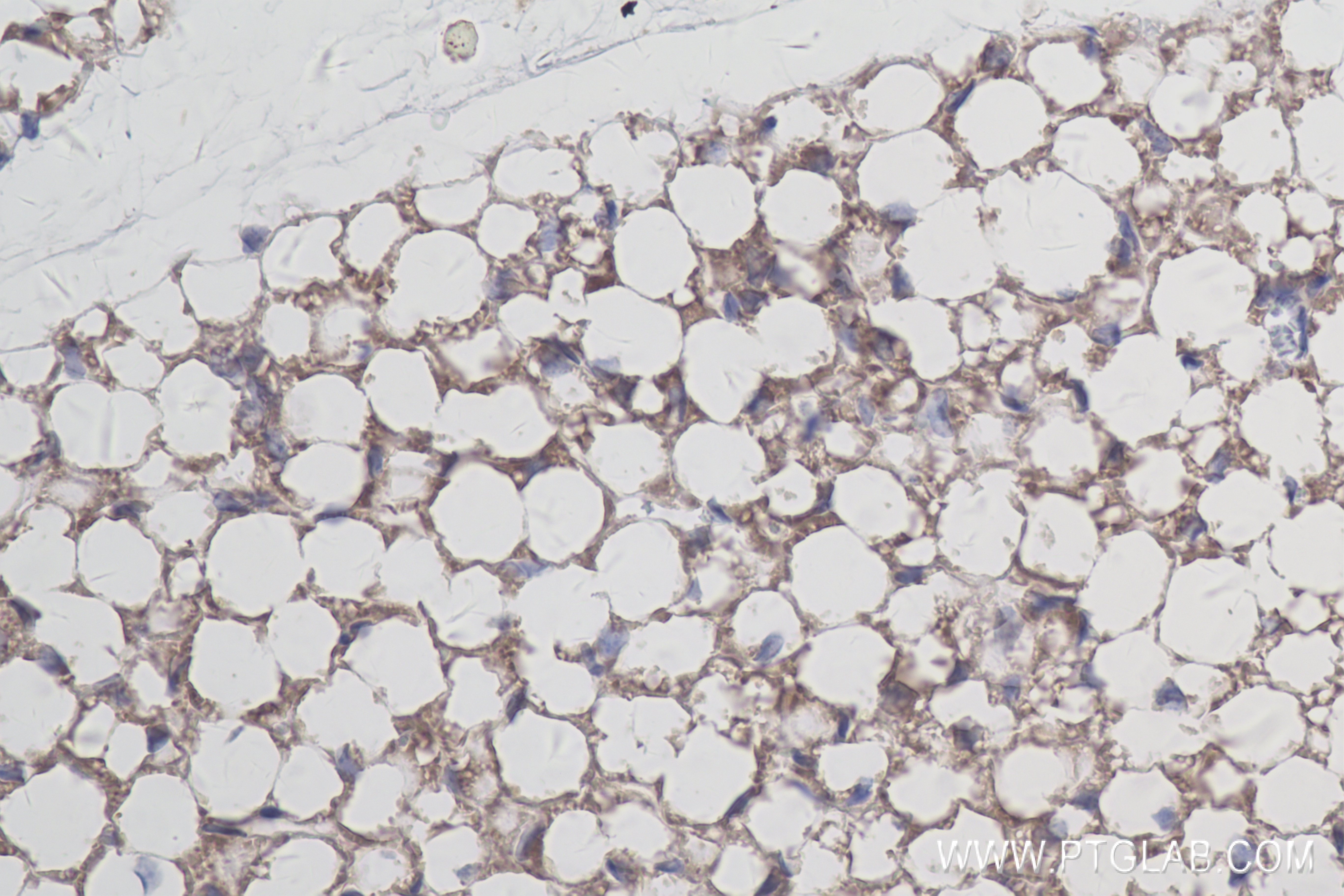 IHC staining of mouse brown adipose using 83961-3-RR (same clone as 83961-3-PBS)