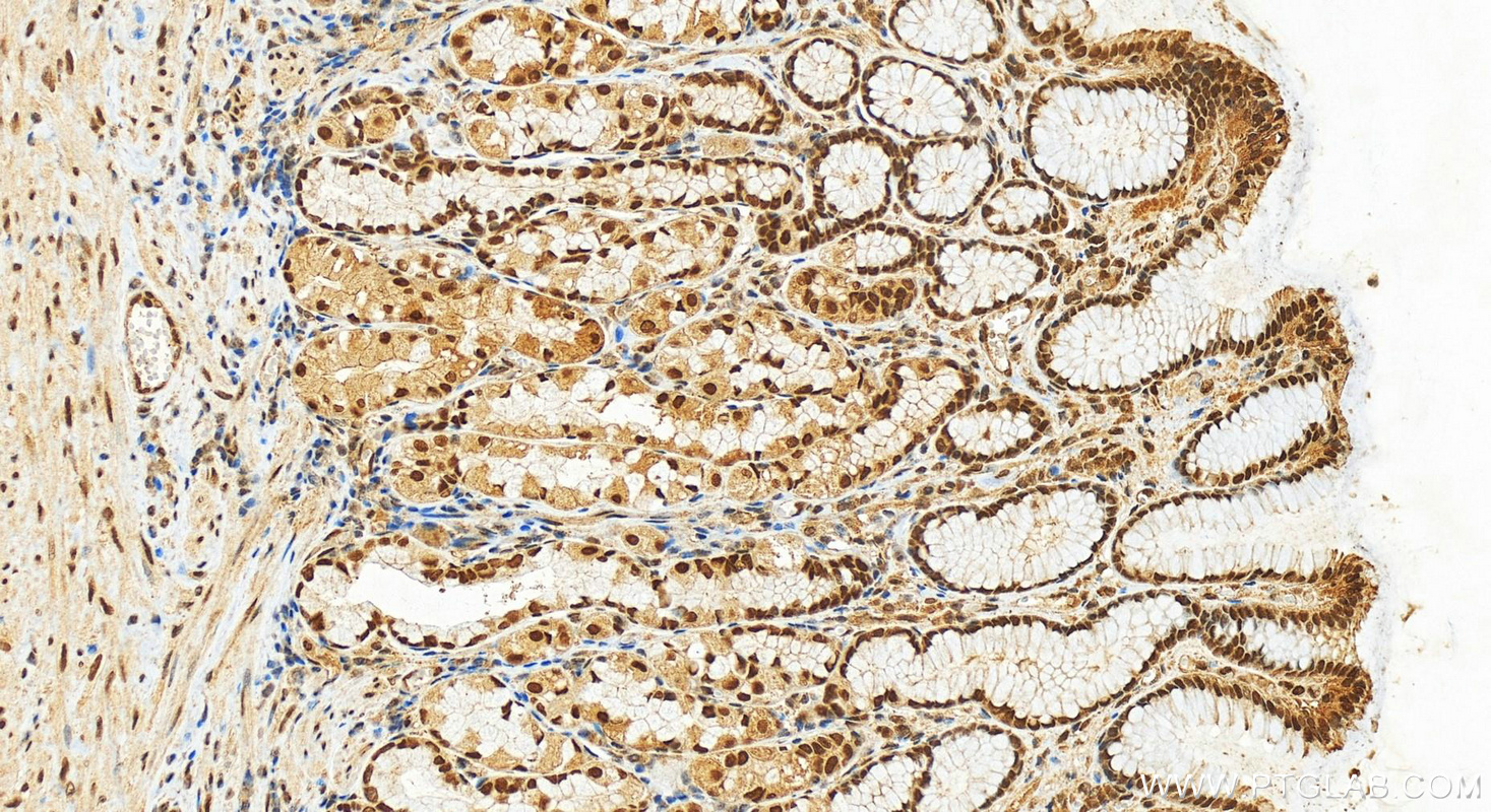 IHC staining of human stomach using 17987-1-AP