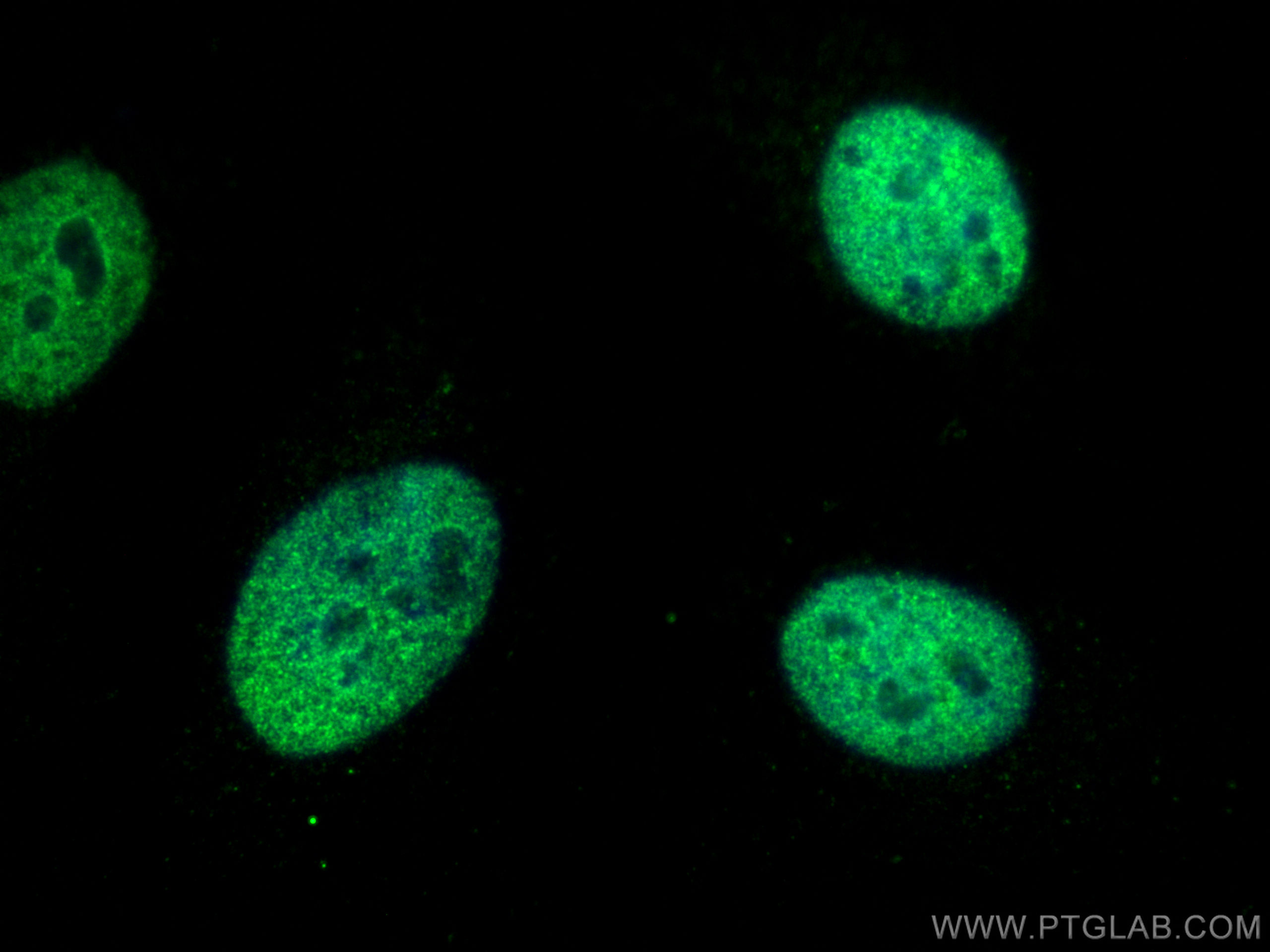 IF Staining of HeLa using 17987-1-AP