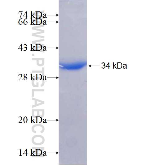 ADPRHL1 fusion protein Ag8847 SDS-PAGE