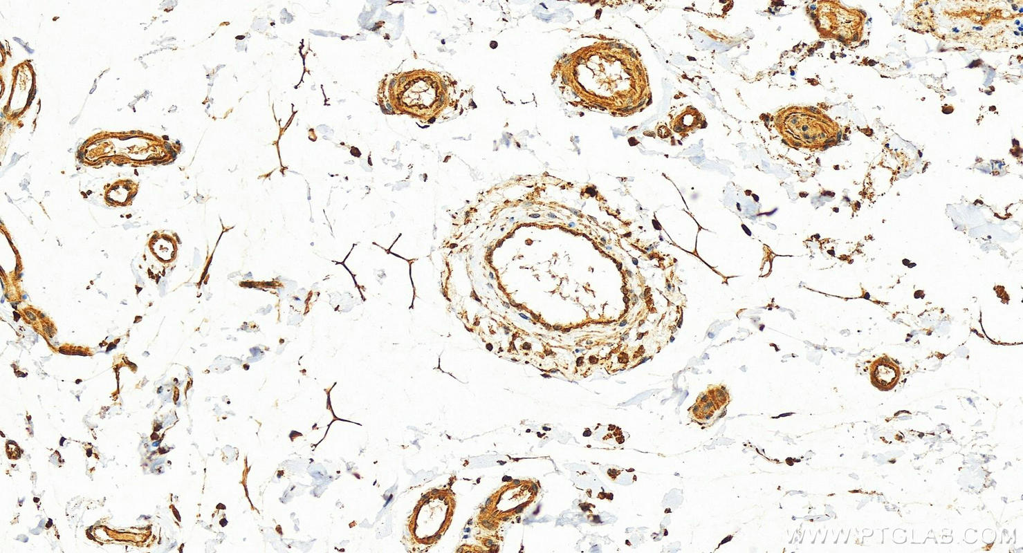 IHC staining of human colon using 13727-1-AP