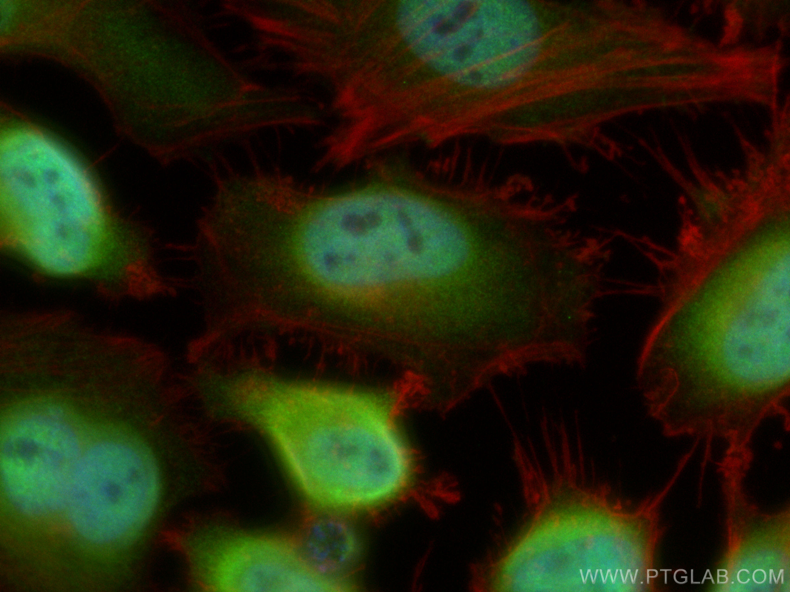 IF Staining of HeLa using 11468-1-AP