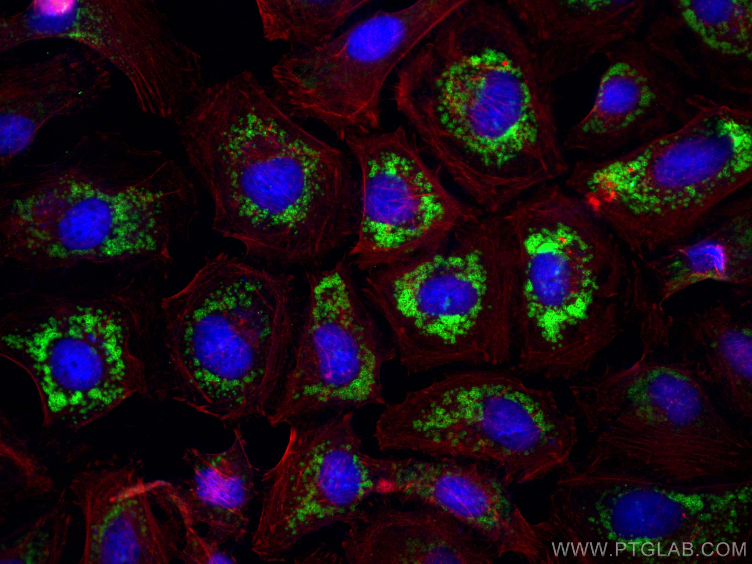 IF Staining of HeLa using 15294-1-AP