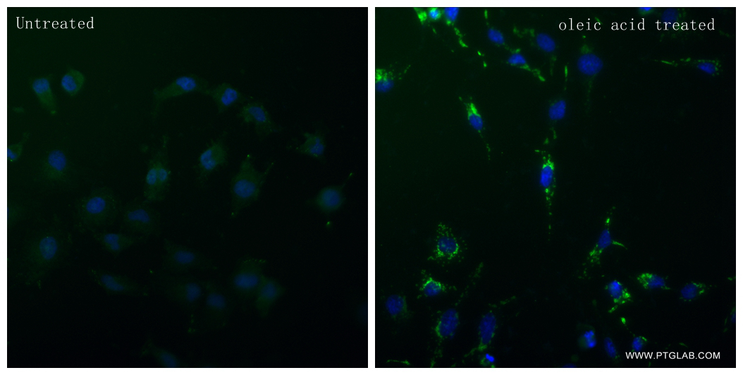 IF Staining of HeLa using 80362-2-RR (same clone as 80362-2-PBS)