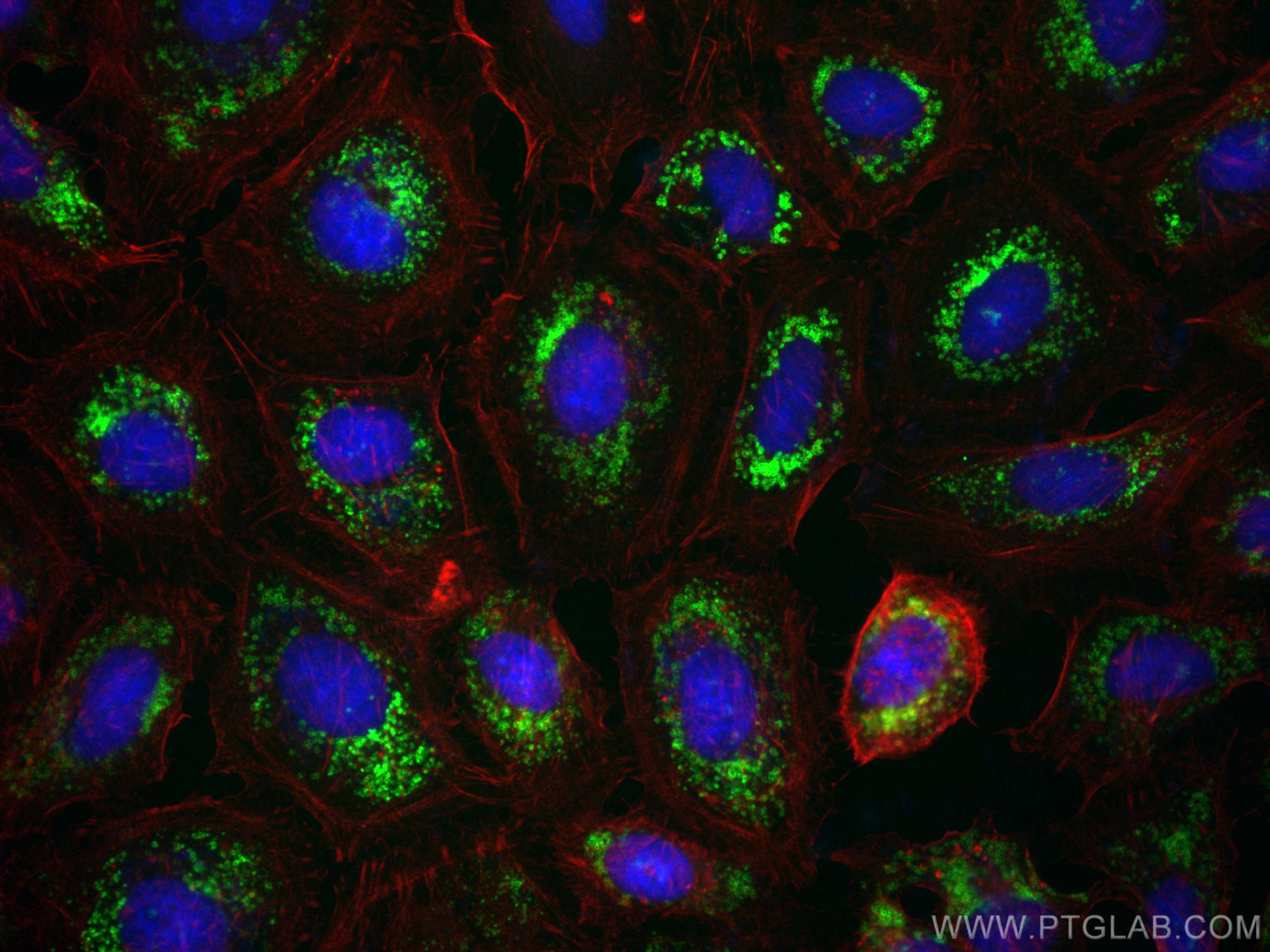 IF Staining of HeLa using 80362-2-RR