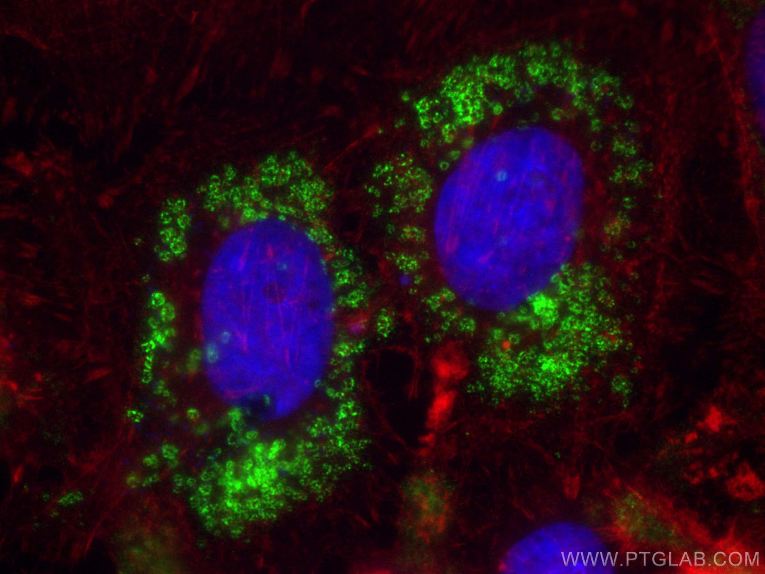 IF Staining of HeLa using 80362-2-RR