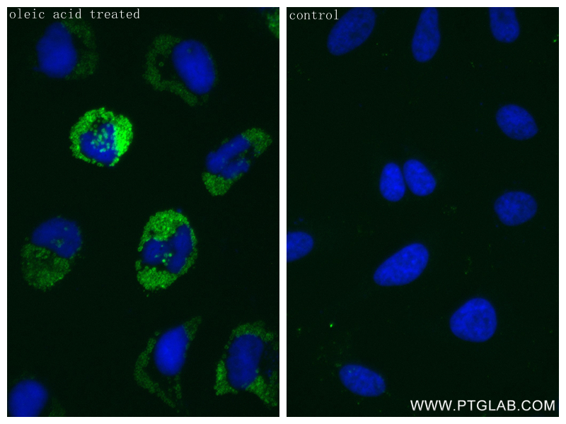 IF Staining of HeLa using 80362-2-RR