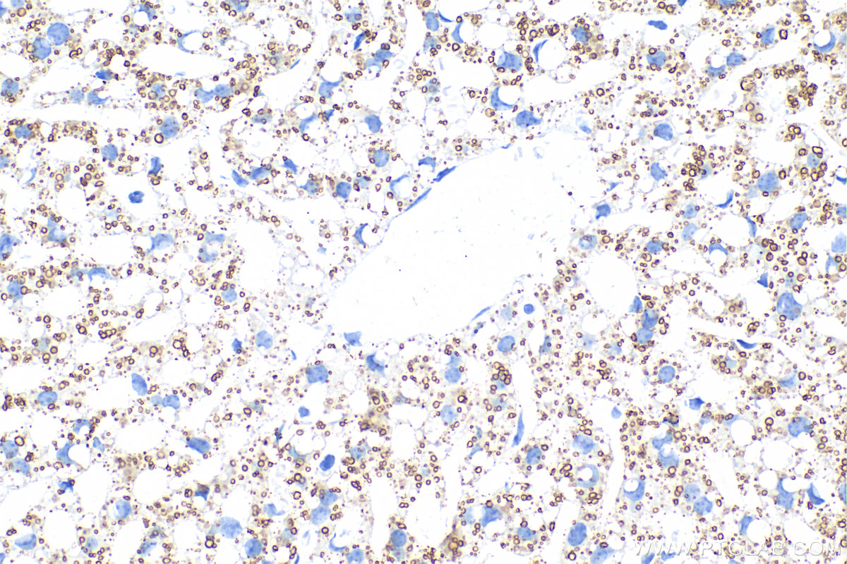 IHC staining of mouse liver using 80362-2-RR