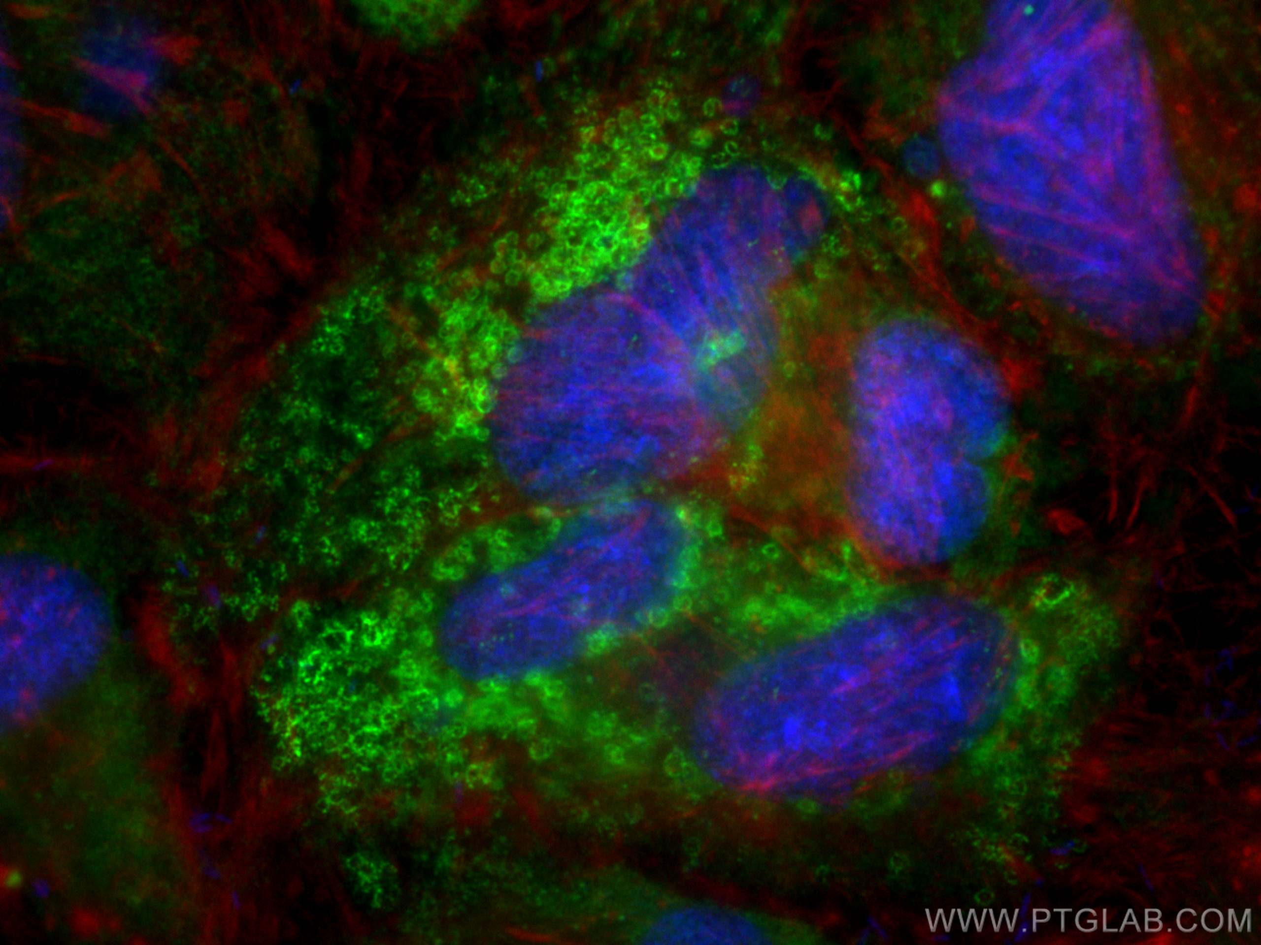 IF Staining of HeLa using CL488-80362-2