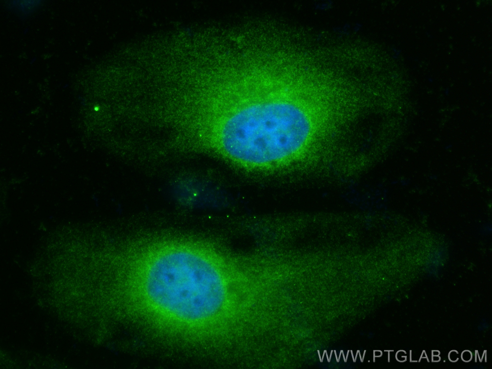 IF Staining of HeLa using 15264-1-AP