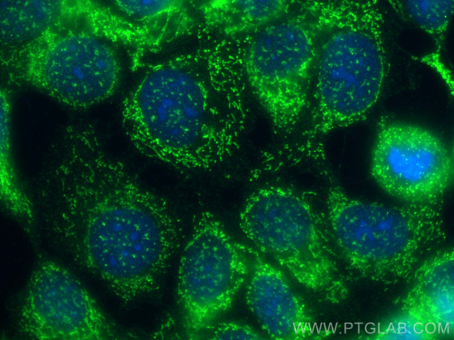 IF Staining of MCF-7 using 68517-1-Ig (same clone as 68517-1-PBS)