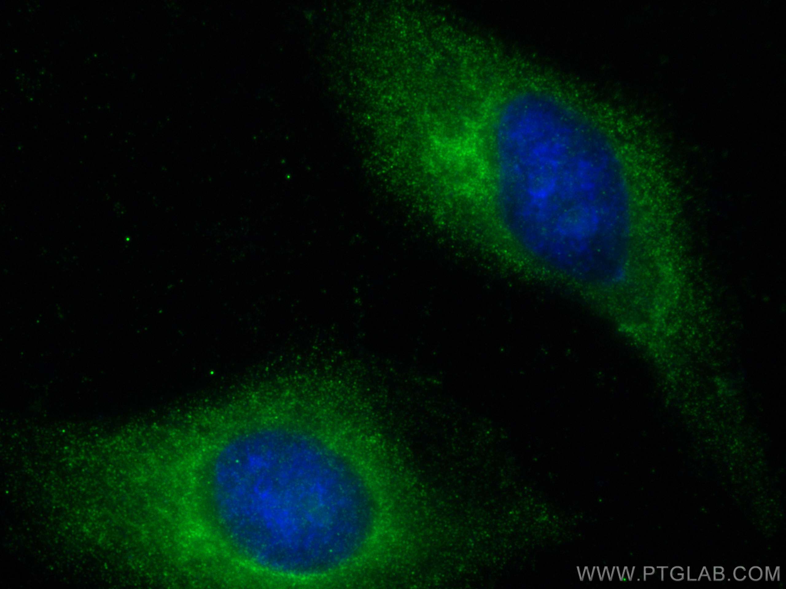 IF Staining of HeLa using 19494-1-AP