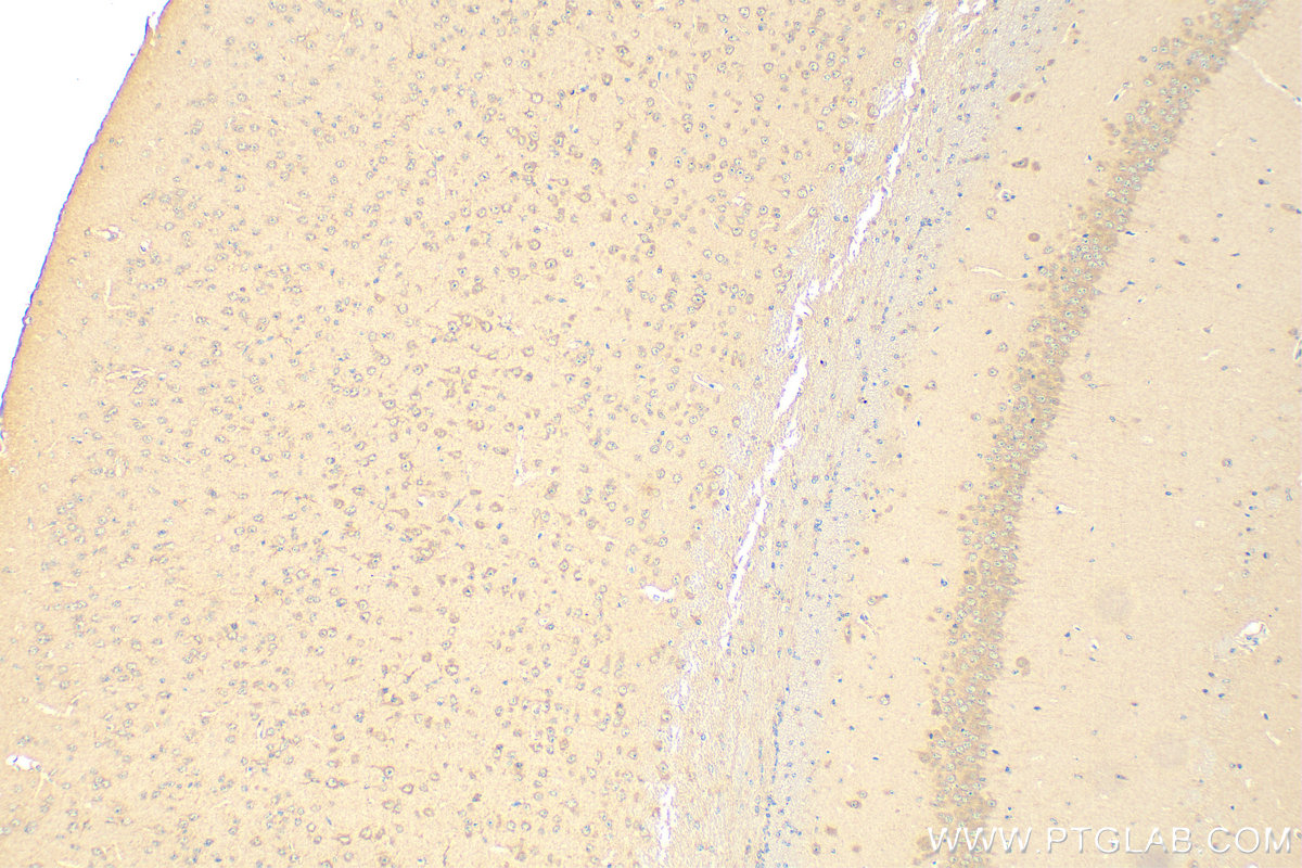 IHC staining of mouse brain using 66113-1-Ig